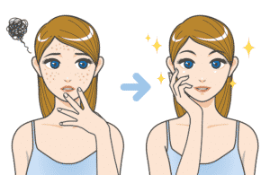 Teens Acne Problems and Their Solutions