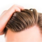 Reasons for Hair Fall in Men
