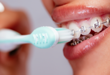 Photo of Best way to treat cavities